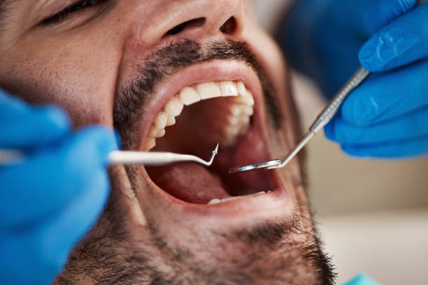 Emergency Dental Services in Moses Lake North, WA