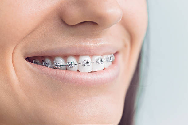 Best Dental Fillings (Composite and Amalgam)  in Moses Lake North, WA